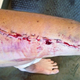 Image for article titled My Severely Busted Ass Is Why You Don't Wear Jeans On A Motorcycle